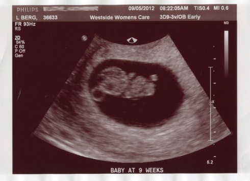first ultrasound