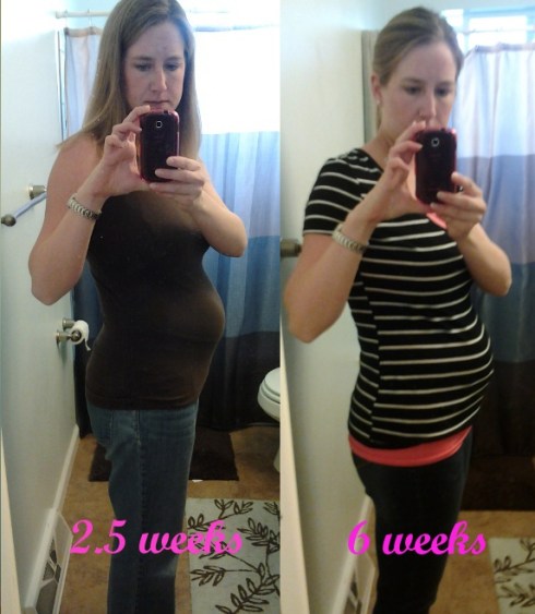 postpartum_comparison_2