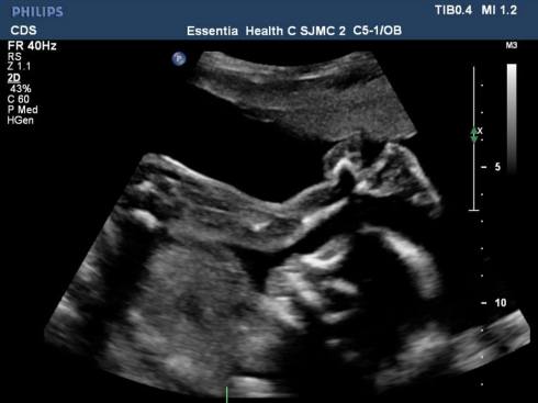 10428447_850898891607101_4829821911885653690_n