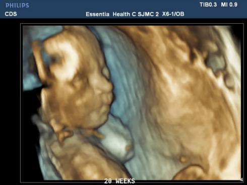 1509037_850898904940433_6891209828618443299_n